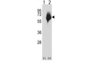 Western blot analysis of MMP2 antibody and 293 cell lysate either nontransfected (Lane 1) or transiently transfected (2) with the MMP2 gene. (MMP2 Antikörper  (AA 303-331))