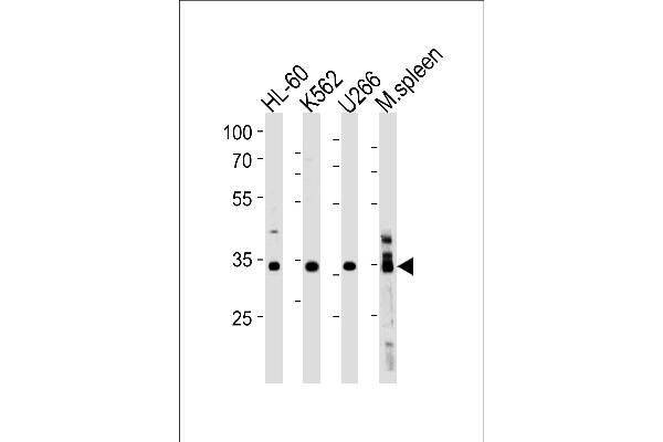 GFI1B Antikörper  (C-Term)