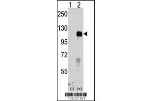 Western blot analysis of EphB4 using rabbit polyclonal EphB4 Antibody. (EPH Receptor B4 Antikörper)