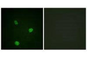 Immunofluorescence analysis of HeLa cells, using MITF (Ab-180/73) antibody. (MITF Antikörper  (Ser73, Ser180))