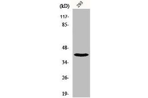 Western Blot analysis of 293 cells using NBPF1/9/10/12/14/15/16/20 Polyclonal Antibody (NBPF12/NBPF1/NBPF1/NBPF9/NBPF2/NBPF15/NBPF14 (C-Term) Antikörper)