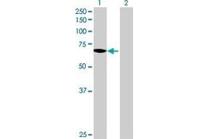 Lane 1: SLC27A1 transfected lysate ( 71.
