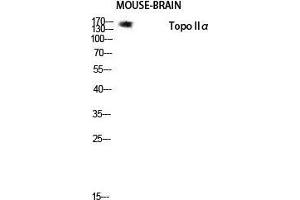Western Blot (WB) analysis of Mouse Brain lysis using Topo IIalpha antibody. (Topo IIalpha (Tyr174) Antikörper)