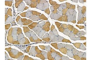 ABIN7094266 and ABIN7098313 at 1/100 staining mouse muscle tissue by IHC-P.