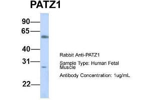 Host:  Rabbit  Target Name:  PATZ1  Sample Type:  Human Fetal Muscle  Antibody Dilution:  1. (PATZ1 Antikörper  (N-Term))