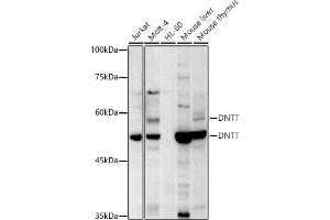 Western blot analysis of extracts of various cell lines, using TdT antibody (ABIN6130878, ABIN6139759, ABIN6139760 and ABIN6221856) at 1:500 dilution. (TdT Antikörper  (AA 260-509))