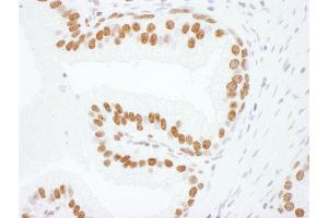 Immunohistochemistry (IHC) image for anti-Heterogeneous Nuclear Ribonucleoprotein L (HNRNPL) (C-Term) antibody (ABIN7795592) (HNRNPL Antikörper  (C-Term))