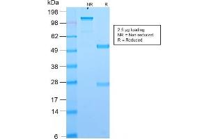 SDS-PAGE Analysis Purified DOG-1 Rabbit Recombinant Monoclonal Antibody (DG1/2564R). (Rekombinanter ANO1 Antikörper  (AA 2-101))