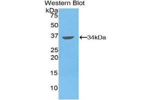 Western Blotting (WB) image for anti-Matrix Metallopeptidase 7 (Matrilysin, Uterine) (MMP7) (AA 1-267) antibody (ABIN1859858) (MMP7 Antikörper  (AA 1-267))