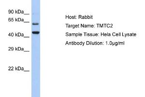 Host: Rabbit Target Name: TMTC2 Sample Type: Hela Whole cell lysates Antibody Dilution: 1. (TMTC2 Antikörper  (C-Term))