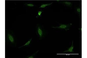 Immunofluorescence of monoclonal antibody to CDR2 on HeLa cell. (CDR2 Antikörper  (AA 296-404))