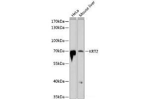Western blot analysis of extracts of various cell lines using KRT2 Polyclonal Antibody at dilution of 1:1000.