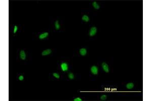 Immunofluorescence of monoclonal antibody to HDAC1 on HeLa cell. (HDAC1 Antikörper  (AA 1-482))