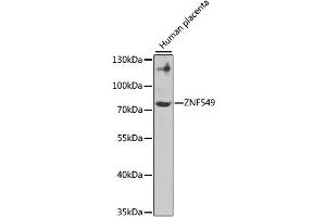 Western blot analysis of extracts of Human placenta, using ZNF549 antibody (ABIN4905684). (ZNF549 Antikörper)