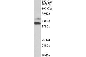 ABIN5539924 (1µg/ml) staining of Human Colorectal Cancer lysate (35µg protein in RIPA buffer). (PYROXD1 Antikörper  (N-Term))