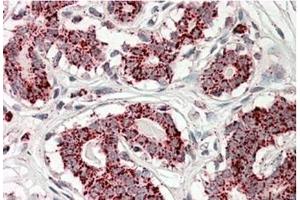 AP23725PU-N ACO2 Antibody staining of paraffin embedded Human Breast at 3. (ACO2 Antikörper  (Internal Region))