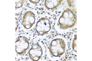 Immunohistochemistry of paraffin-embedded human colon using IFI44 antibody at dilution of 1:100 (40x lens). (IFI44 Antikörper)