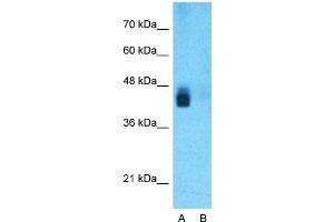 Western Blotting (WB) image for anti-Beta-secretase 1 (BACE1) (N-Term) antibody (ABIN2782766)