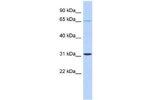 WB Suggested Anti-ZNF691 Antibody Titration:  0. (ZNF691 Antikörper  (Middle Region))