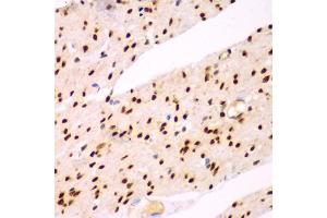 Immunohistochemistry of paraffin-embedded human colon using TEAD3 antibody (ABIN5975292) at dilution of 1/100 (40x lens). (TEAD3 Antikörper)