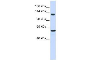 IGSF1 antibody used at 1 ug/ml to detect target protein. (IGSF1 Antikörper  (Middle Region))