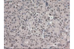 Immunohistochemical staining of paraffin-embedded colon using anti-Notch1 (ABIN2452671) mouse monoclonal antibody. (Notch1 Antikörper  (AA 2300-2556))
