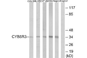 Immunohistochemistry analysis of paraffin-embedded human placenta tissue using CYB5R3 antibody. (CYB5R3 Antikörper  (Internal Region))