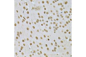 Immunohistochemistry of paraffin-embedded mouse brain using ILK Antibody (ABIN5970329) at dilution of 1/200 (40x lens).
