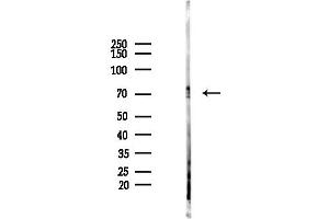 Western blot analysis of lysates from Mouse brain, using Phospho-Tau (Thr217/Thr534) Antibody at 1/1000 dilution.