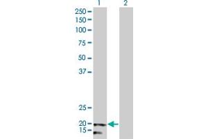 Western Blot analysis of NDUFB5 expression in transfected 293T cell line by NDUFB5 monoclonal antibody (M01), clone 5G5.