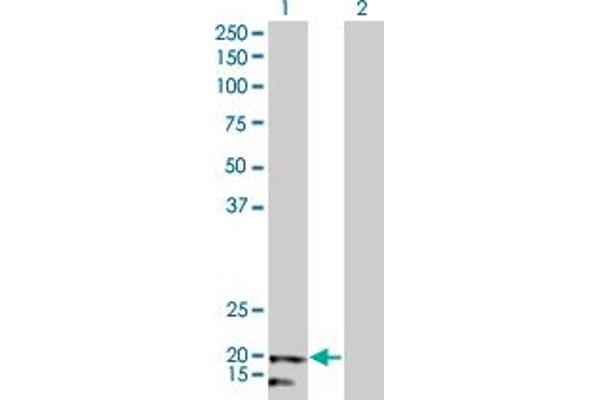 NDUFB5 Antikörper  (AA 95-189)