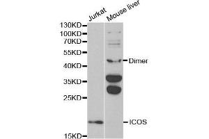 Western blot analysis of extracts of various cell lines, using ICOS antibody. (ICOS Antikörper  (AA 21-140))
