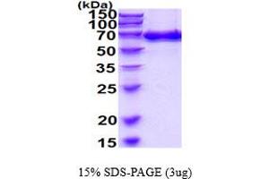 SDS-PAGE (SDS) image for Endoglin (ENG) (AA 27-581) protein (His tag) (ABIN6387814)