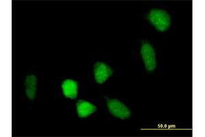 Immunofluorescence of purified MaxPab antibody to BCOR on HeLa cell. (BCOR Antikörper  (AA 1-1004))