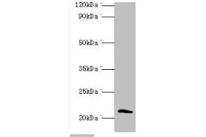 Western blot All lanes: Protein SSX2 antibody at 2 μg/mL + MDA-MB-231 whole cell lysate Secondary Goat polyclonal to rabbit IgG at 1/10000 dilution Predicted band size: 22, 26 kDa Observed band size: 22 kDa (SSX2 Antikörper  (AA 1-188))
