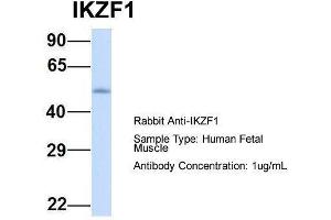 Host:  Rabbit  Target Name:  IKZF1  Sample Type:  Human Fetal Muscle  Antibody Dilution:  1. (IKZF1 Antikörper  (Middle Region))