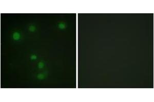 Immunofluorescence analysis of HuvEc cells, using Retinoblastoma (Ab-826) Antibody. (Retinoblastoma Protein (Rb) Antikörper  (AA 601-650))