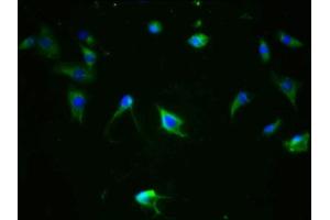 Immunofluorescence staining of SH-SY5Y cells with ABIN7127710 at 1:100,counter-stained with DAPI. (Rekombinanter MAPT Antikörper  (pSer324))