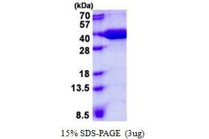 Image no. 1 for Prefoldin Subunit 3 (PFDN3) protein (His tag) (ABIN1098492)
