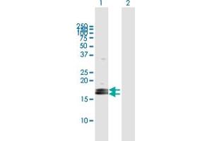 Western Blot analysis of LOC124220 expression in transfected 293T cell line by LOC124220 MaxPab polyclonal antibody.