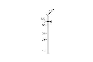 Western blot analysis of lysate from LNCap cell line, using CYP51A1 Antibody (Center) (ABIN652820 and ABIN2842535). (CYP51A1 Antikörper  (AA 250-279))