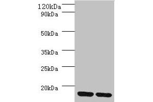 Western blot All lanes: MRPL55 antibody at 2 μg/mL Lane 1: K562 whole cell lysaye Lane 2: PC-3 whole cell lysaye Secondary Goat polyclonal to rabbit IgG at 1/10000 dilution Predicted band size: 16, 19 kDa Observed band size: 16 kDa (MRPL55 Antikörper  (AA 34-128))