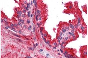 Human Prostate: Formalin-Fixed, Paraffin-Embedded (FFPE) (RRAS2 Antikörper  (AA 1-205))