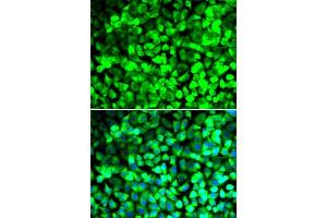 Immunofluorescence analysis of U2OS cells using EIF5 antibody. (EIF5 Antikörper  (AA 1-235))