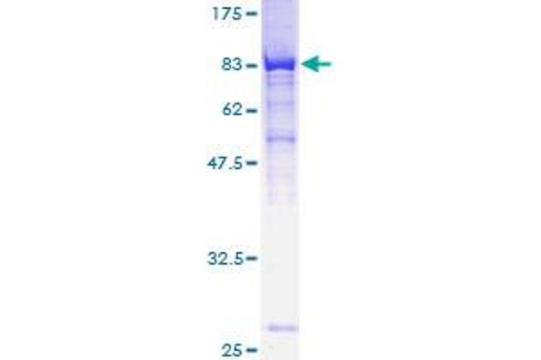 MPP6 Protein (AA 1-540) (GST tag)