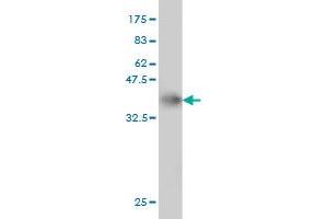 Western Blot detection against Immunogen (36. (TBCK Antikörper  (AA 601-700))