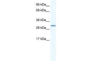Western Blotting (WB) image for anti-Spi-C Transcription Factor (Spi-1/PU.1 Related) (SPIC) antibody (ABIN2461611)