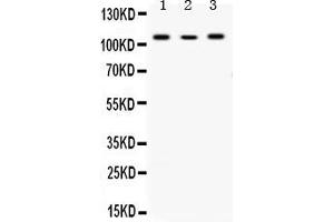 Western blot analysis of Alpha Actinin 4 expression in rat liver extract ( Lane 1), NEURO whole cell lysates ( Lane 2) and RAJI whole cell lysates ( Lane 3). (alpha Actinin 4 Antikörper  (AA 561-661))