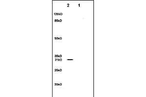 Lane 1: rat brain lysates Lane 2: rat heart lysates probed with Anti- SFRP1 Polyclonal Antibody, Unconjugated (ABIN674694) at 1:200 in 4C. (SFRP1 Antikörper  (AA 201-314))