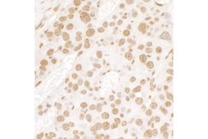 Immunohistochemistry (IHC) image for anti-Fused in Sarcoma (FUS) (AA 1-50) antibody (ABIN7448573) (FUS Antikörper  (AA 1-50))